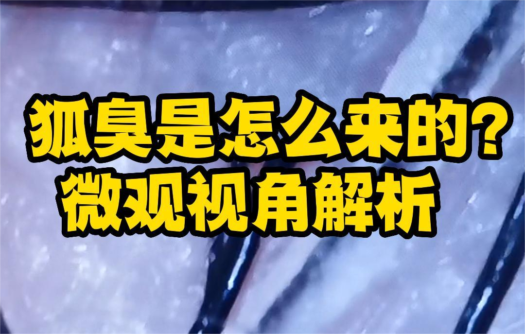 你(nǐ)講過狐臭的(de)微(wēi)觀視(shì)角嗎(ma)？