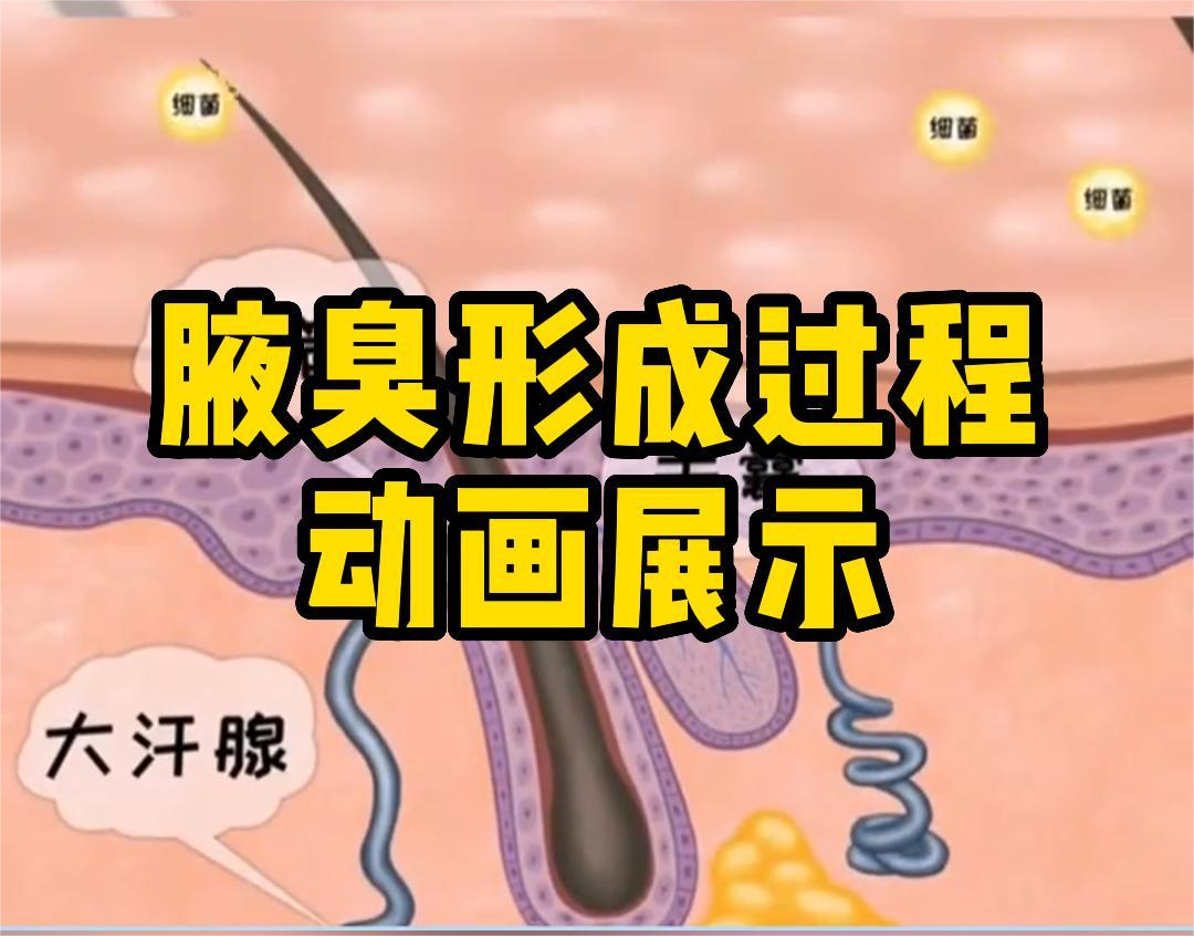 腋臭形成過程動畫(huà)！簡單易懂(dǒng)！