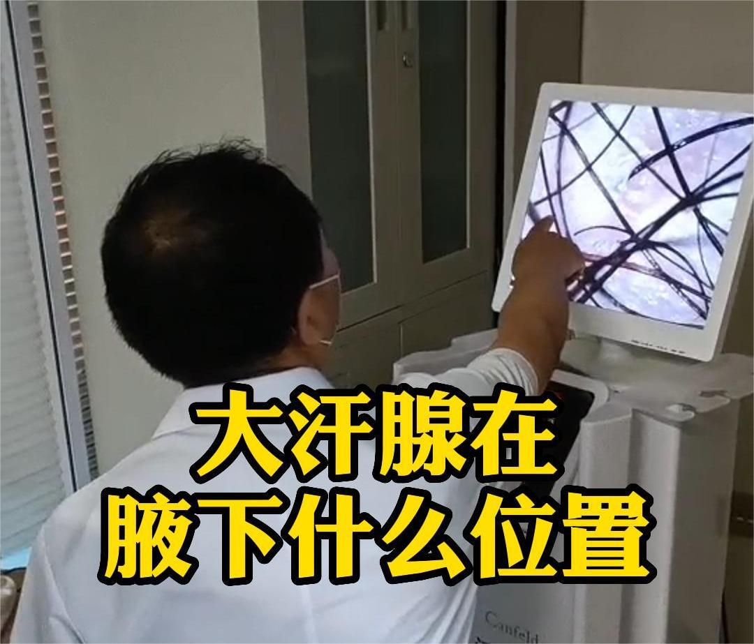 大(dà)汗腺到(dào)底在什(shén)麽地(dì)方？（真實就(jiù)診實錄）