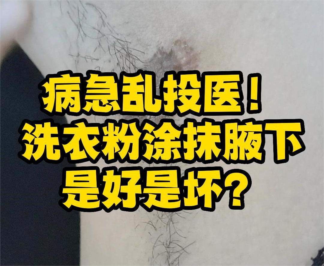 狐臭應該怎麽治？有(yǒu)人(rén)用(yòng)洗衣粉塗抹腋下(xià)